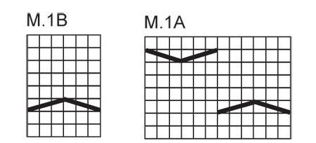 mönster av en fläta med en nålskugga ett diagram med en beskrivning 