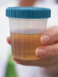 Om ett protein i urinen finns, vad betyder det?