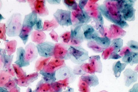 Ett smet på cytologi som visar