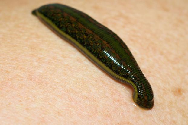 behandling med leeches: vad är användningen och skadan